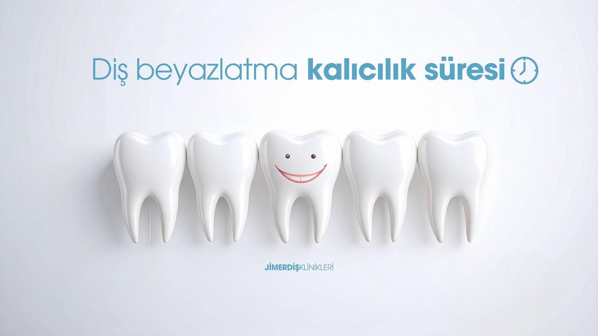 Teeth Whitening Retention Time