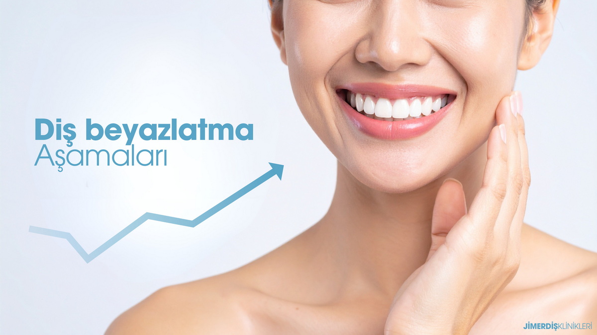 Jimer Dental Clinics Teeth Whitening Stages