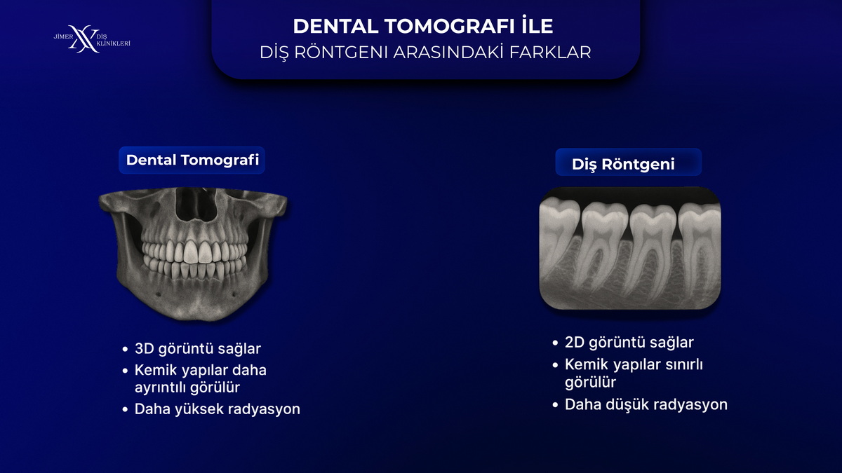 What are Volumetric Dental Tomography and Panoramic X-Ray?