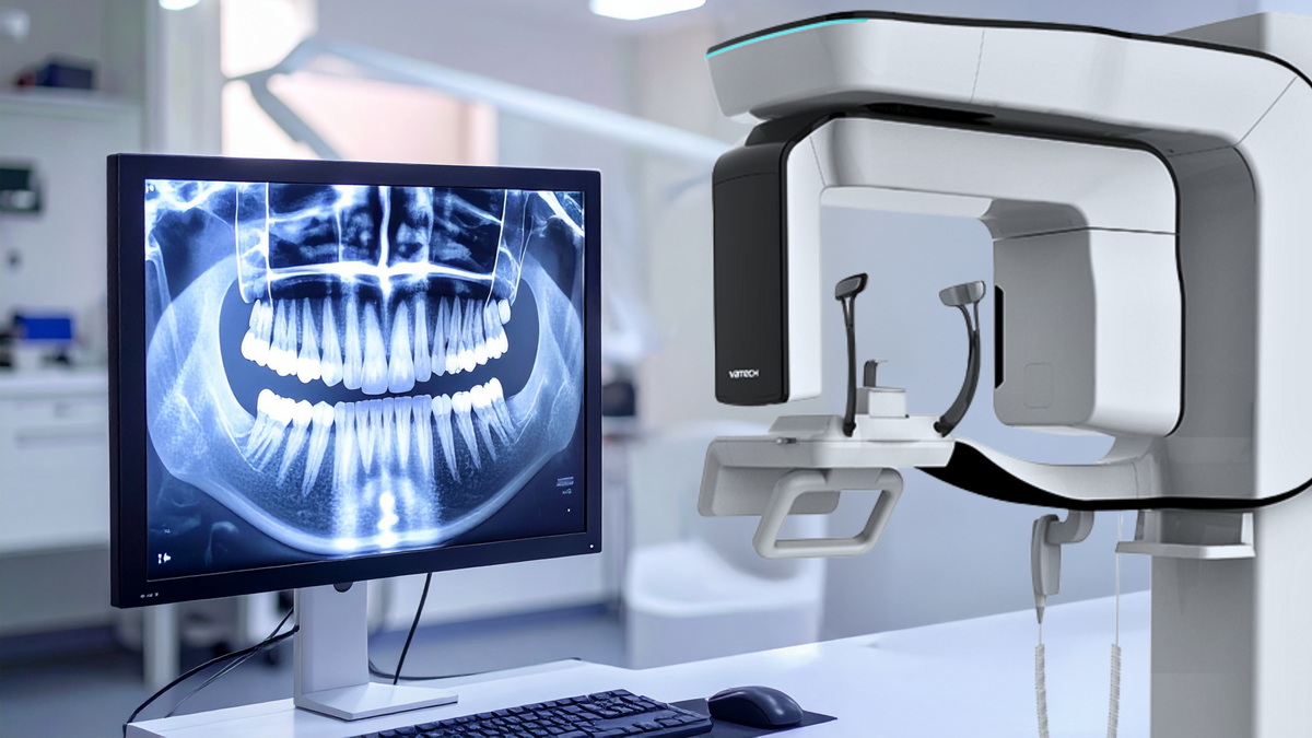 How is a Dental CT Scan Performed?