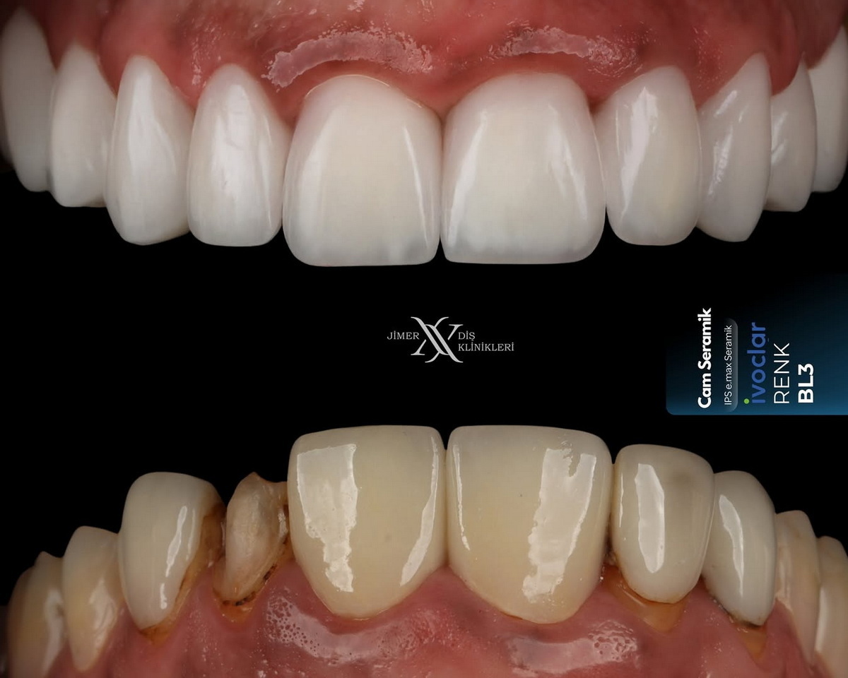 What is Cosmetic Dentistry?