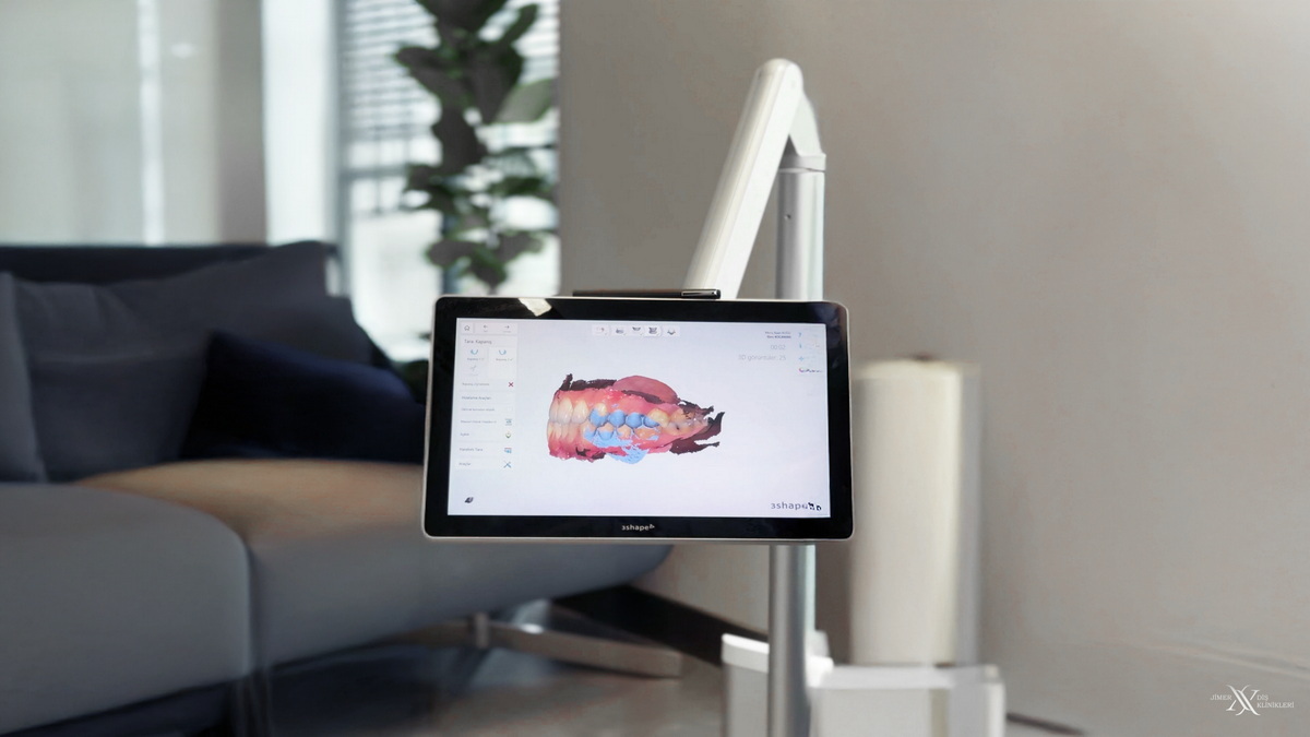 Bursa Digital Smile Design (DSD) and Planning